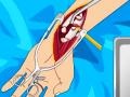 游戏Arm surgery 2
