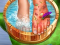 游戏Feet Skin Doctor