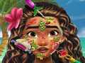 游戏Moana Skin Doctor