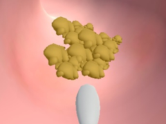 游戏Earwax Clinic